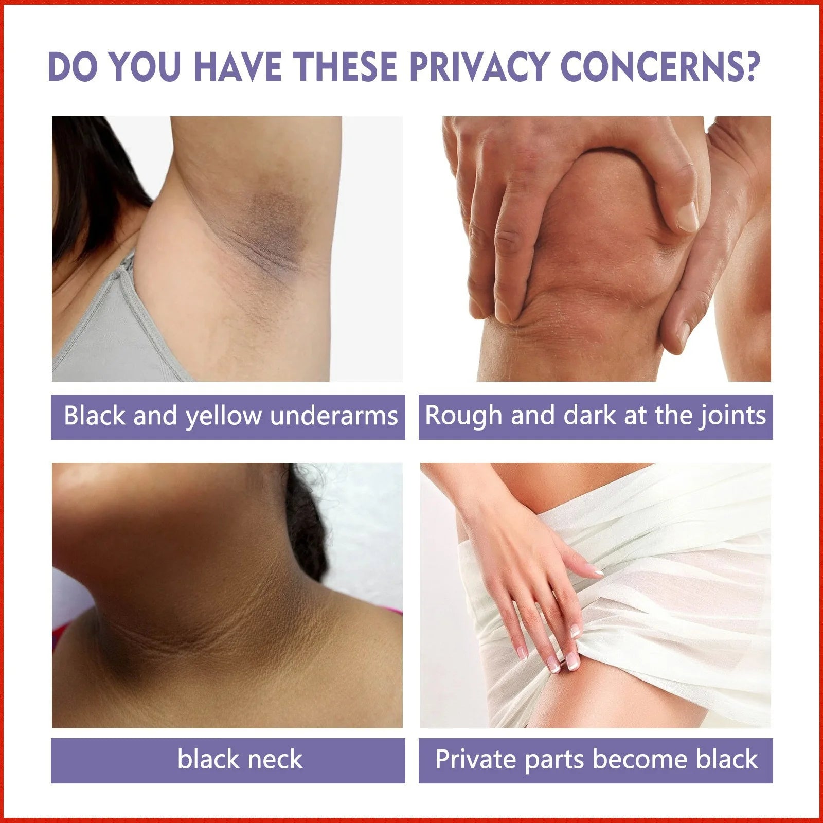 EELHOE Beauty Bar Body Hydrating, Moisturizing, Brightening, Pigments Brightening, Whitening, and Translucent Care Cream