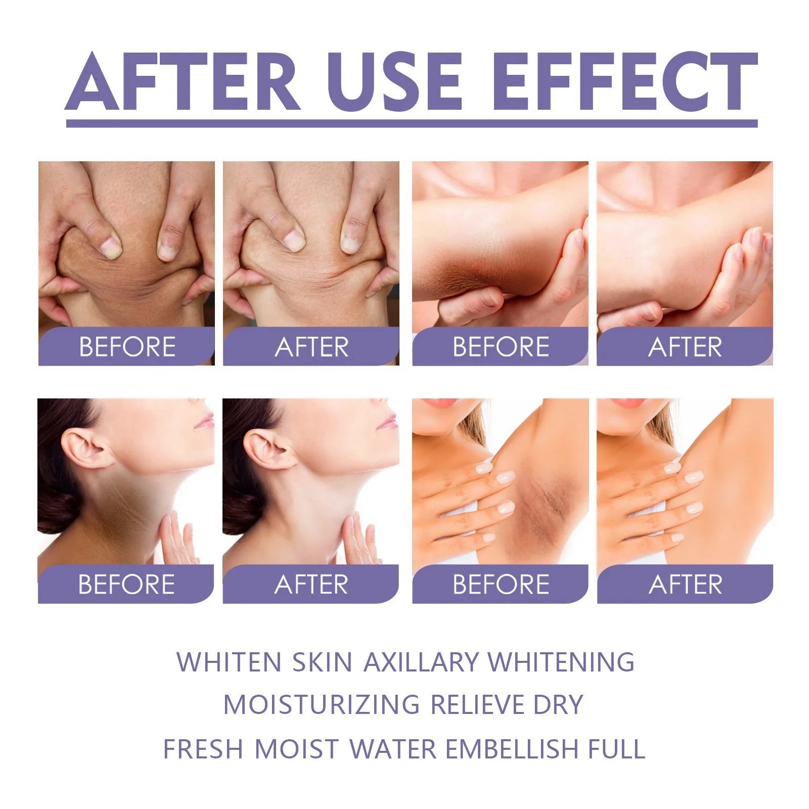 EELHOE Beauty Bar Body Hydrating, Moisturizing, Brightening, Pigments Brightening, Whitening, and Translucent Care Cream