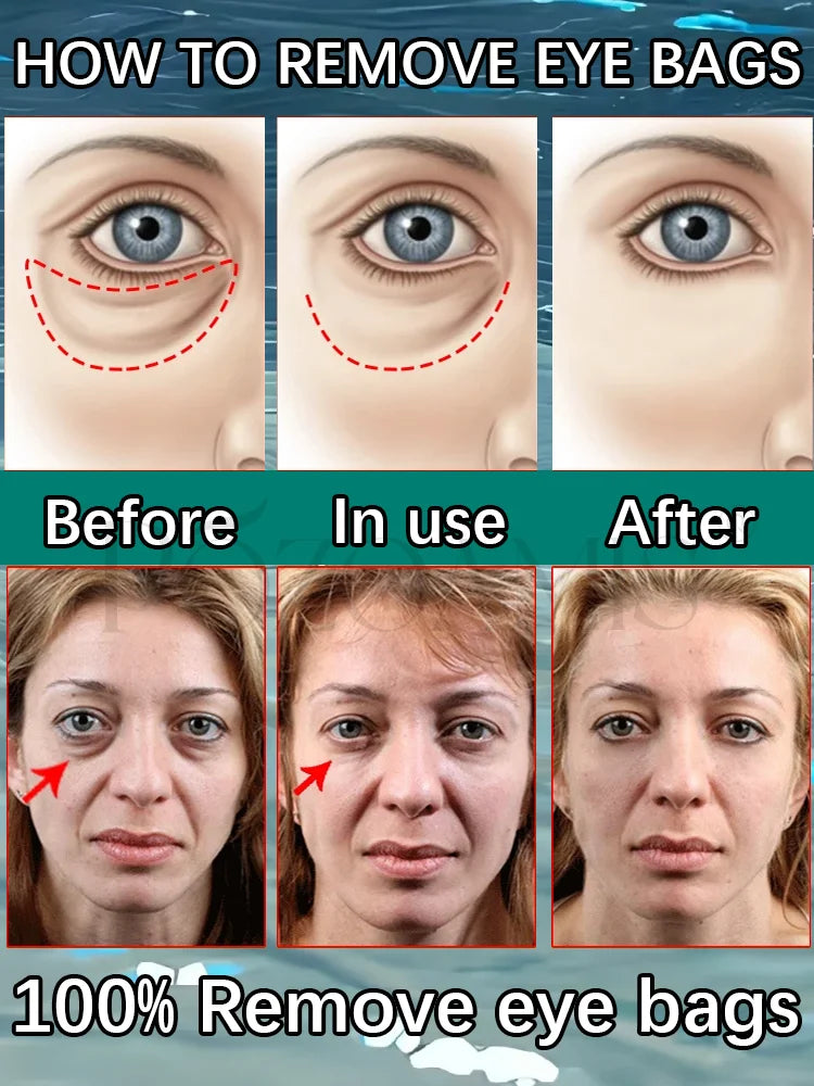 ᴷᵉᵉᵖ ʸᵒᵘʳ ᵉʸᵉˢ ᶠᵒʳᵉᵛᵉʳ ʸᵒᵘⁿᵍ