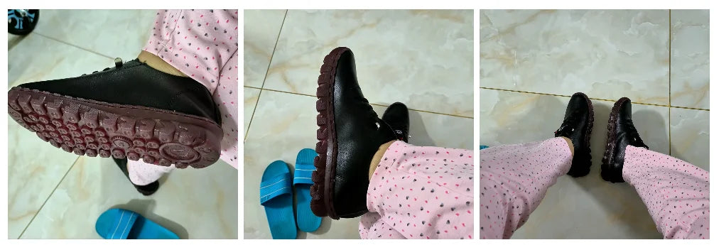 Spring Shockproof Orthopedic Shoes For Women Autumn Lace Up Flats Women's Loafers Ladies Comfort Moccasins Female Driver Shoes