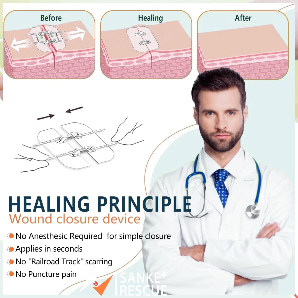 2-4PCS Zipper Painless Wound Closure Device Suture-free Wound Dressing Closure Strips Kit Emergency Laceration Closures for Ifak