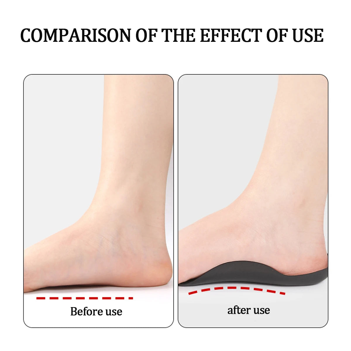 2PCS Arch Support | Half Arch Correct Insoles - Orthotic Shoe Insoles High Arch Support for Plantar (Black)